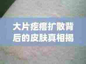 大片疙瘩扩散背后的皮肤真相揭秘