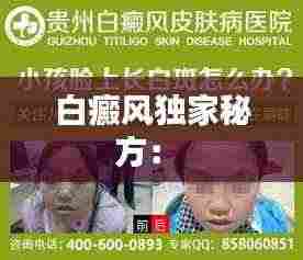 白癜风独家秘方: