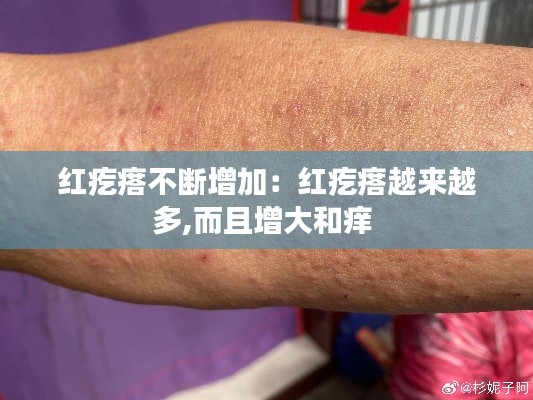 打张鸡儿 第3页